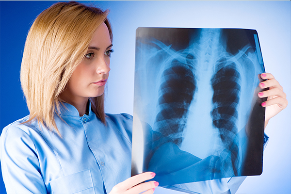 early symptoms of lung cancer