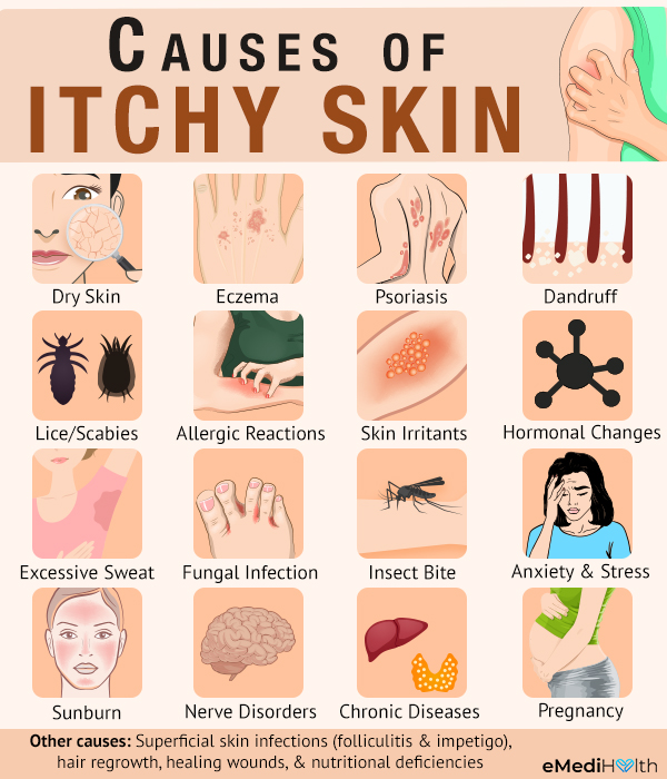 common causes of itchy skin