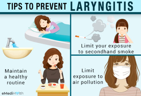 How Long is Laryngitis Contagious, Explained by an ENT