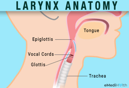 laryngitis causes