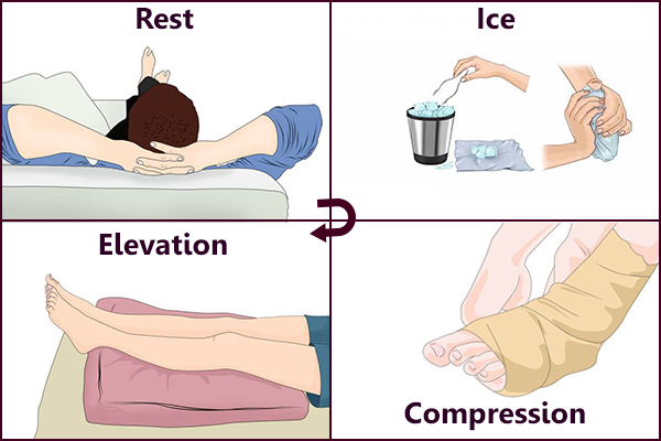 steps involved in RICE treatment