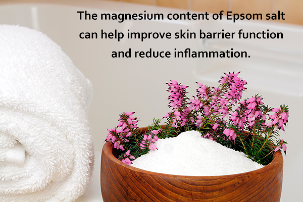 Epsom salt can help soothe itchy skin