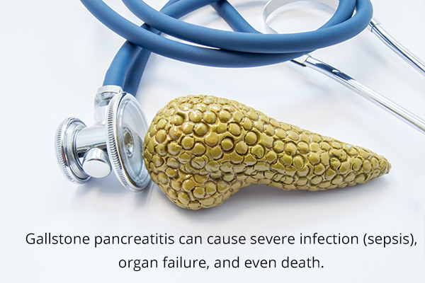 risks and complications of gallstone pancreatitis
