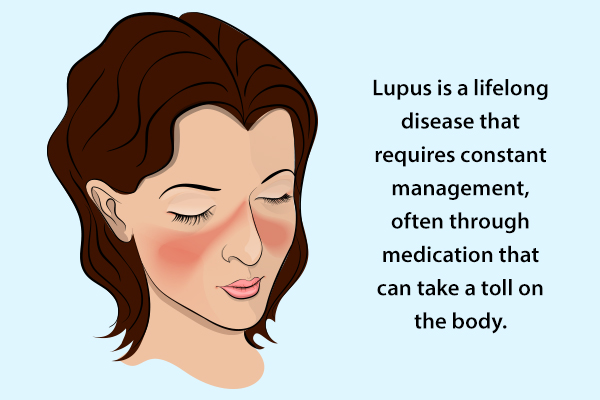 correct diagnosis for lupus