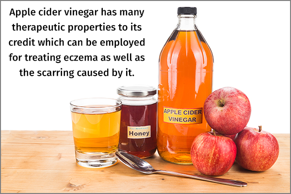 apple cider vinegar can help treat eczema