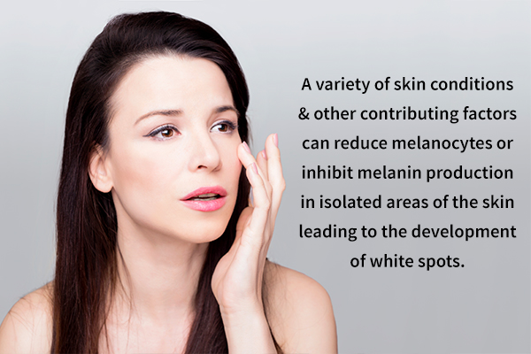 what causes white spots on skin?