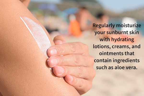 treatment for sunburn