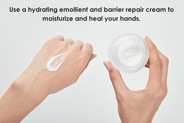 treatment for dry and rough hands