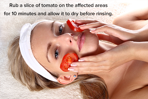 tomato can help fade age spots