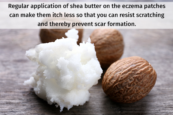 applying shea butter can help prevent scar formation