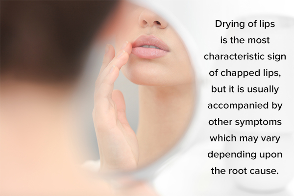symptoms indicating chapped lips