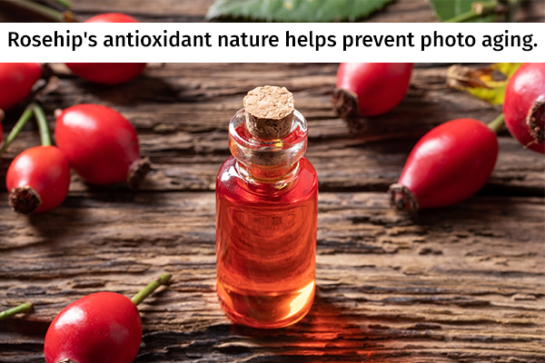 use rose hip oil or supplements
