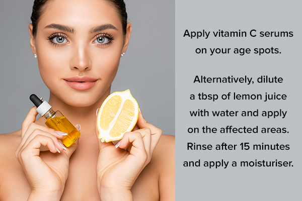 topical application of vitamin C can help reduce age spots