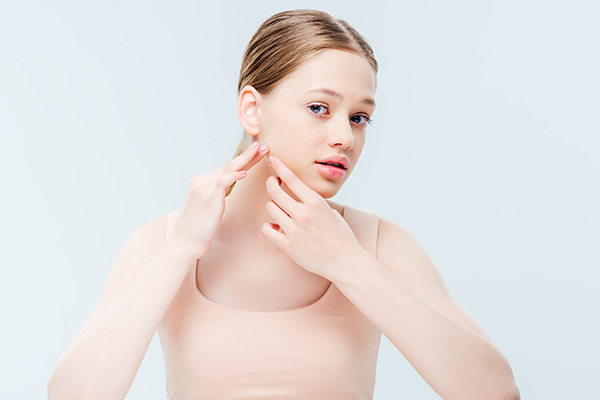 general queries about pimples