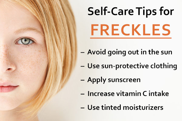 self-care tips for freckles