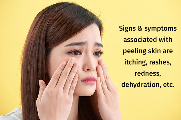 symptoms associated with peeling skin