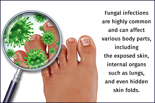 categorization of fungal infections