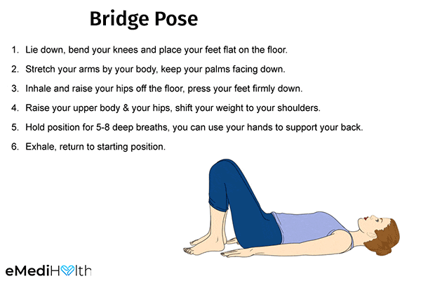 bridge pose can help deal with period problems