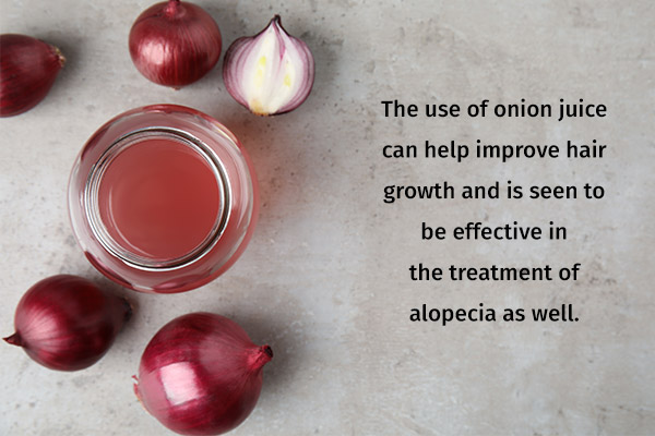 onion juice application can help boost hair growth