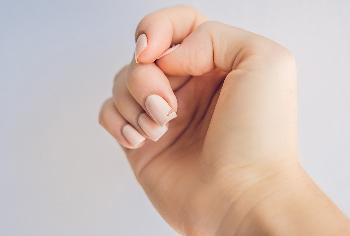 Brittle Nails: Top Causes & Natural Remedies That Work