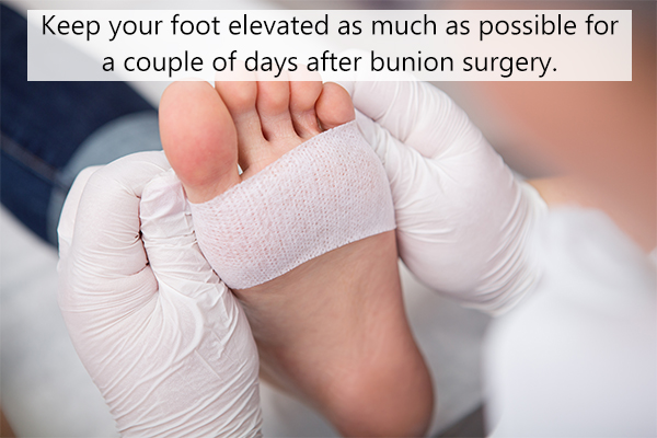 bunion surgery recovery tips