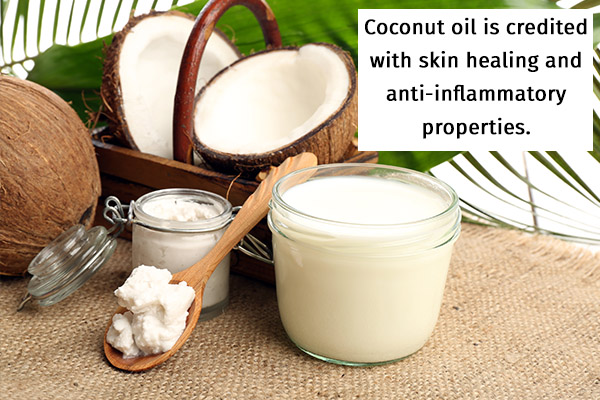 coconut oil possesses skin healing virtues