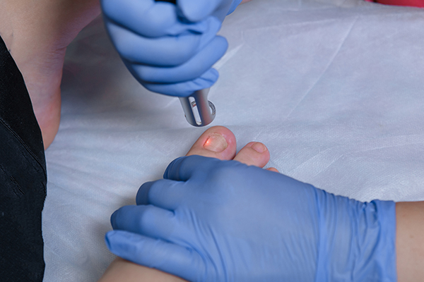 diagnosis of an ingrown toenail