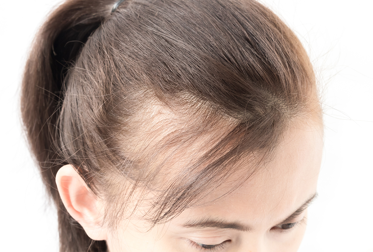 How to Regrow Lost Hair: Natural Remedies, Ayurveda and Hair Products