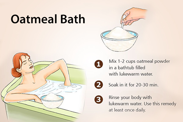 take an oatmeal bath to relieve psoriasis