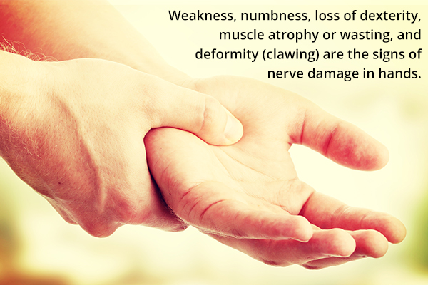 nerve-damage-in-hands-causes-symptoms-treatment