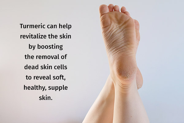 turmeric can help treat cracked heels and dry skin