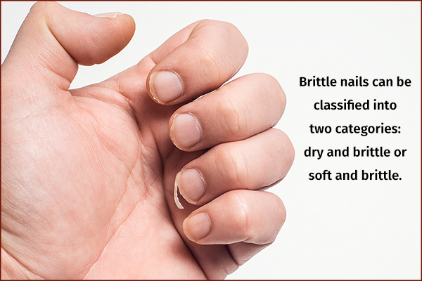 types of brittle nails