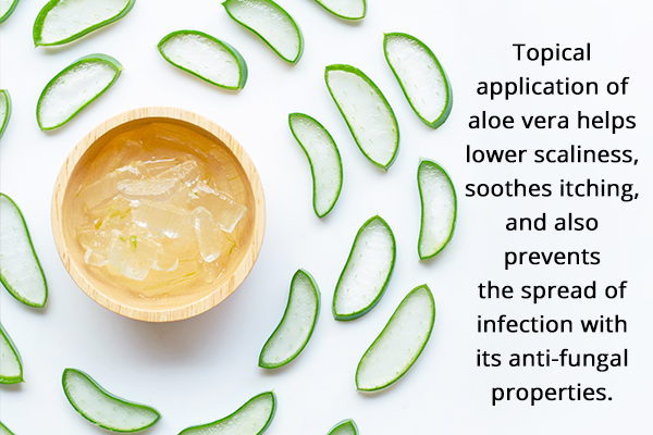 aloe vera gel hair masks can help manage scalp infections