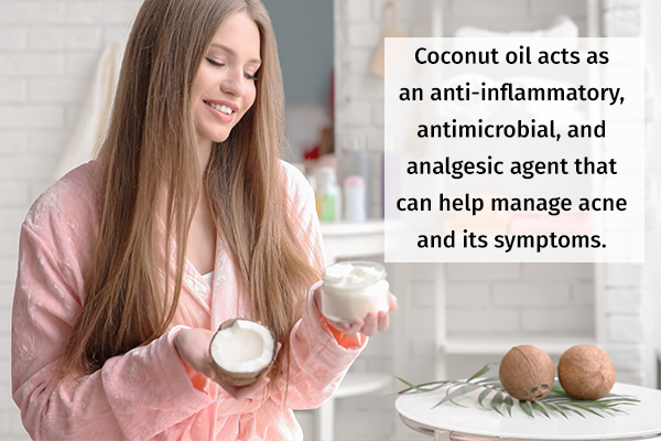 coconut oil mask can help manage acne