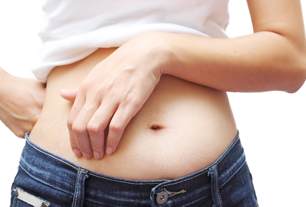 Belly Button Infection: Causes, Symptoms, & Treatment