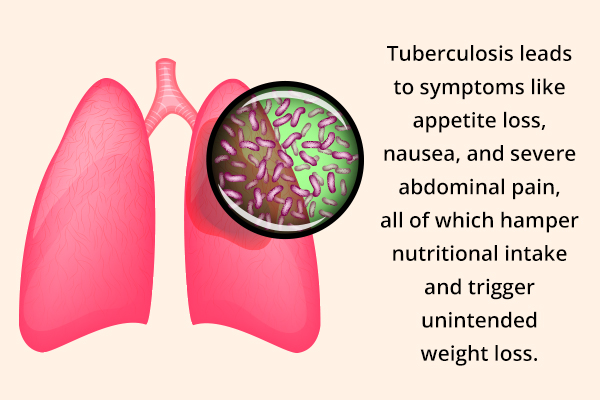 tuberculosis can indirectly trigger unintended weight loss