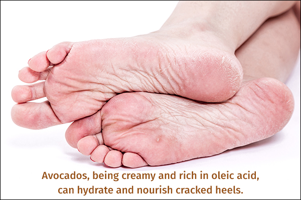 avocado can nourish dry skin and heal cracked heels