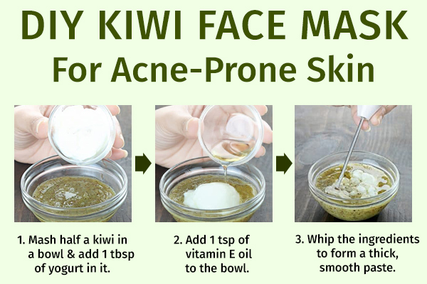 diy kiwi face mask for acne-prone skin