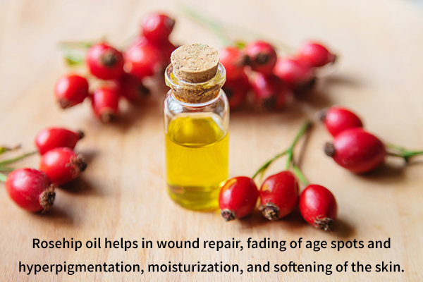 rosehip oil helps in fading of age spots and hyperpigmentation