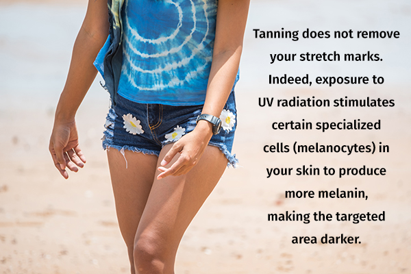 tanning removes stretch marks is a myth