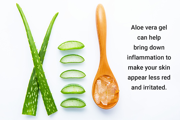 aloe vera gel can help soothe skin inflammation