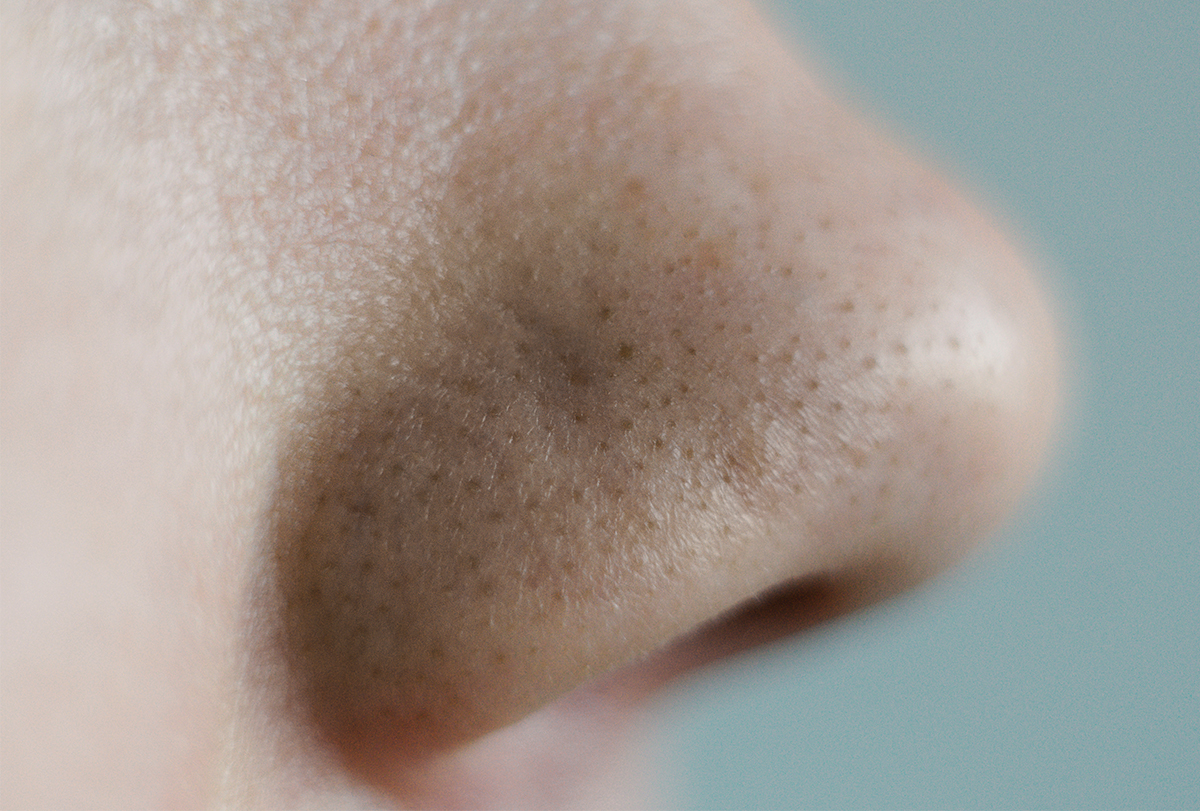 get rid of clogged pores