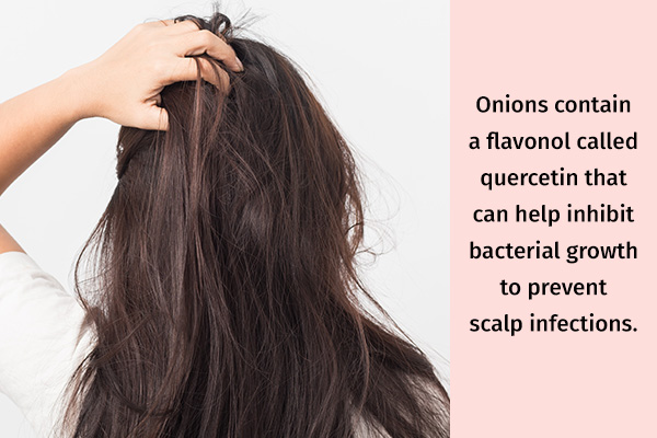onion hair oils can help ward off scalp infections