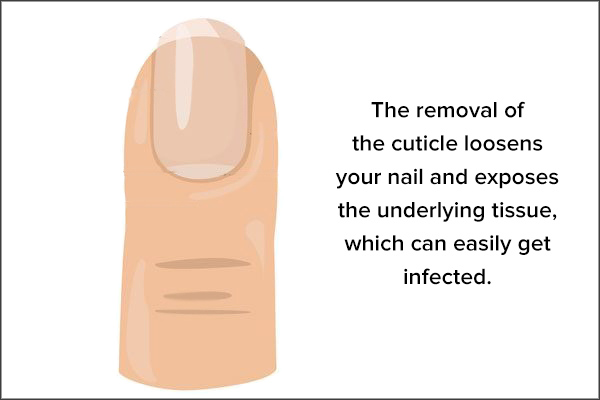 never pluck or remove the nail cuticles