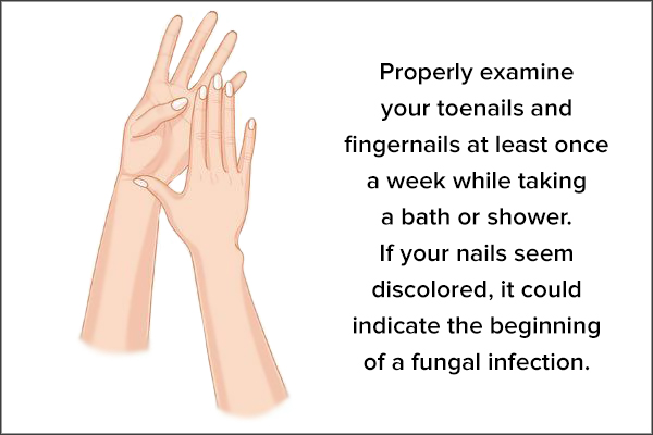 properly look out for any signs of nail infections