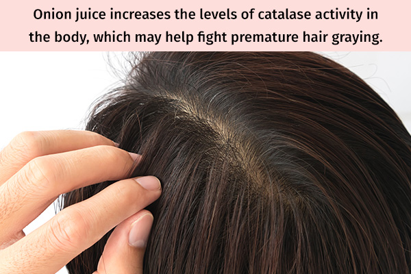 onion juice can help manage premature graying of hair