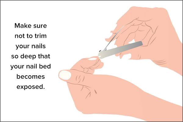 make sure to trim your nails properly