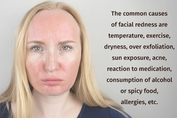 How To Cure Redness On Face 6 Home Remedies And Treatment 7727