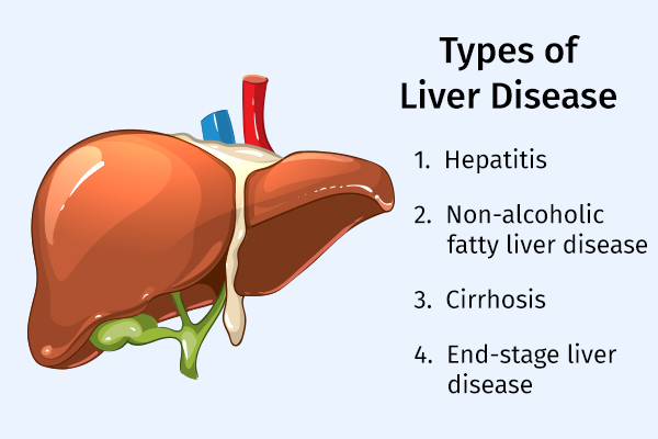 main types of liver disease
