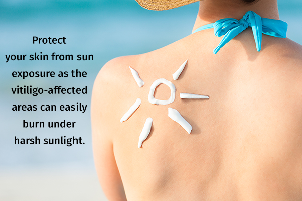 protect your skin from sun exposure